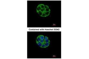 ICC/IF Image Immunofluorescence analysis of methanol-fixed Hep G2, using ASB5, antibody at 1:500 dilution. (ASB5 抗体)