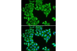 Immunofluorescence analysis of HeLa cells using SPAG5 antibody (ABIN6290586). (SPAG5 抗体)