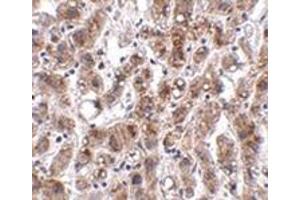 Immunohistochemistry of THEM2 in human liver tissue with this product at 2. (THEM2 抗体  (C-Term))