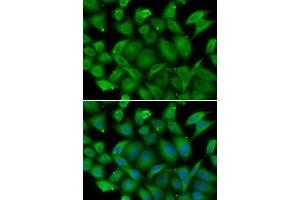 Immunofluorescence analysis of HeLa cells using DEFA1 antibody. (alpha Defensin 1 抗体  (AA 1-94))