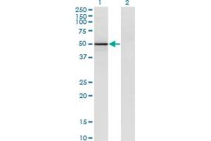 Western Blot analysis of VIL1 expression in transfected 293T cell line by VIL1 monoclonal antibody (M26), clone 2F10. (Villin 1 抗体  (AA 1-421))