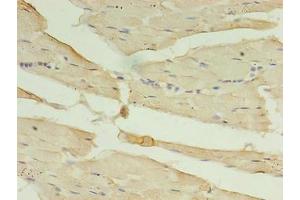 Immunohistochemistry of paraffin-embedded human skeletal muscle tissue using ABIN7146727 at dilution of 1:100 (CA5B 抗体  (AA 34-314))