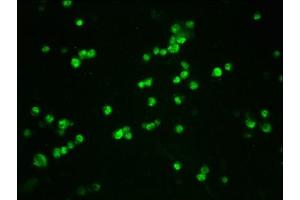 Immunofluorescence staining of 293T cells(treated with 50nM Calyculin A for 30 min) with ABIN7127686 at 1:100,counter-stained with DAPI.