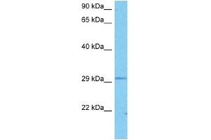 Host:  Mouse  Target Name:  HOXC4  Sample Tissue:  Mouse Liver  Antibody Dilution:  1ug/ml (HOXC4 抗体  (N-Term))