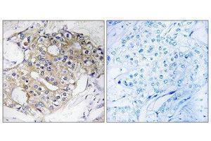 Immunohistochemistry (IHC) image for anti-Dehydrogenase/reductase (SDR Family) Member 4 (DHRS4) (C-Term) antibody (ABIN1851226) (DHRS4 抗体  (C-Term))