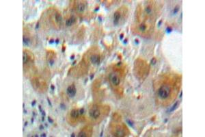 IHC-P analysis of Liver tissue, with DAB staining. (Caspase 8 抗体  (AA 217-384))