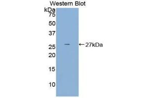 Western blot analysis of the recombinant protein. (DCL1 抗体  (AA 21-225))