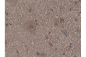 Detection of MFAP2 in Rat Spinal cord Tissue using Polyclonal Antibody to Microfibrillar Associated Protein 2 (MFAP2)