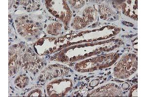 Immunohistochemical staining of paraffin-embedded Human Kidney tissue using anti-AKT1 mouse monoclonal antibody. (AKT1 抗体)