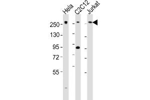 All lanes : Anti-Med12 Antibody (C-term) at 1:2000 dilution Lane 1: Hela whole cell lysates Lane 2: C2C12 whole cell lysates Lane 3: Jurkat whole cell lysates Lysates/proteins at 20 μg per lane. (MED12 抗体  (C-Term))