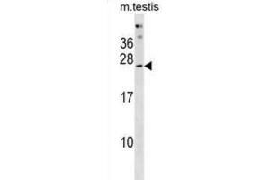 Western Blotting (WB) image for anti-Phosphatase, Orphan 2 (PHOSPHO2) antibody (ABIN3001017) (PHOSPHO2 抗体)