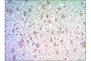 Immunohistochemical analysis of paraffin-embedded human brain tissues using KLHL21 antibody with DAB staining. (KLHL21 抗体)