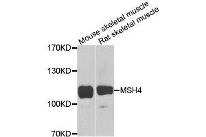Western blot analysis of extracts of various cell lines, using MSH4 antibody (ABIN5996306) at 1/1000 dilution. (MSH4 抗体)