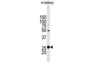 Image no. 1 for anti-Stanniocalcin 2 (STC2) (N-Term) antibody (ABIN356935) (Stanniocalcin 2 抗体  (N-Term))