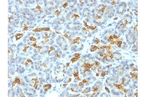 Immunohistochemistry (IHC) image for anti-Keratin 19 (KRT19) antibody (ABIN6939946)