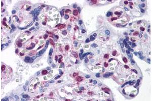 Human Placenta: Formalin-Fixed, Paraffin-Embedded (FFPE) (STK33 抗体  (AA 1-515))