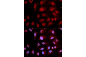 Immunofluorescence analysis of U2OS cells using POLB antibody (ABIN5970839).