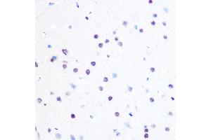 Immunohistochemistry of paraffin-embedded rat brain using PEG3 Rabbit pAb (ABIN6128527, ABIN6145434, ABIN6145435 and ABIN6216398) at dilution of 1:100 (40x lens). (PEG3 抗体  (AA 1-300))