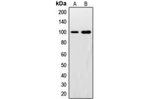 Western blot analysis of Synphilin 1 expression in HeLa (A), U2OS (B) whole cell lysates. (SNCAIP 抗体  (C-Term))