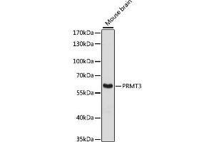 Western blot analysis of extracts of mouse brain, using PRMT3 antibody (ABIN6129634, ABIN6146229, ABIN6146230 and ABIN6216919) at 1:3000 dilution. (PRMT3 抗体  (AA 1-220))
