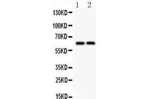 Anti- SLC22A2 Picoband antibody, Western blotting All lanes: Anti SLC22A2  at 0. (SLC22A2 抗体  (Middle Region))