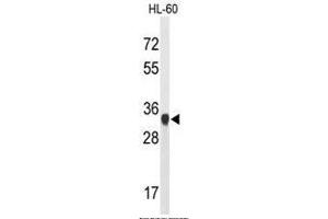 Western blot analysis of ATP5C1 Antibody (N-term) in HL-60 cell line lysates (35µg/lane). (ATP Synthase Subunit gamma (AtpC) (AA 46-76), (N-Term), (Subunit gamma) 抗体)