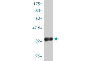 Western Blot detection against Immunogen (34. (ABRACL/C6orf115 抗体  (AA 1-81))
