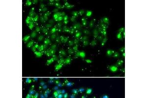 Immunofluorescence analysis of MCF-7 cells using NAT9 Polyclonal Antibody (NAT9 抗体)