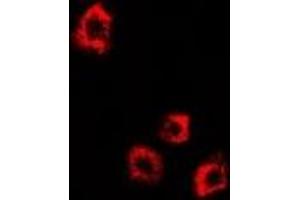 Immunofluorescent analysis of DDX58 staining in HepG2 cells. (DDX58 抗体)