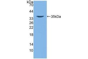 Detection of Recombinant DEFb2, Human using Polyclonal Antibody to Defensin Beta 2 (DEFb2) (beta 2 Defensin 抗体  (AA 24-64))
