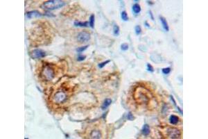 Used in DAB staining on fromalin fixed paraffin-embedded Stomach tissue (IL2RG 抗体  (AA 23-262))
