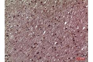 Immunohistochemical analysis of paraffin-embedded human-brain, antibody was diluted at 1:100. (HSD11B1 抗体  (N-Term))