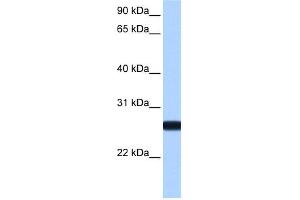 WB Suggested Anti-IL13RA2 Antibody Titration: 0. (IL13RA2 抗体  (N-Term))