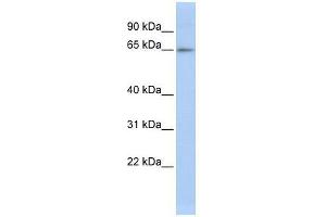 Western Blot showing ZNF619 antibody used at a concentration of 1-2 ug/ml to detect its target protein. (ZNF619 抗体  (N-Term))