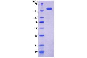 SDS-PAGE analysis of Human ACP6 Protein. (ACP6 蛋白)