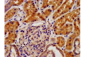 IHC image of ABIN7157473 diluted at 1:500 and staining in paraffin-embedded human kidney tissue performed on a Leica BondTM system. (CRYM 抗体  (AA 169-258))