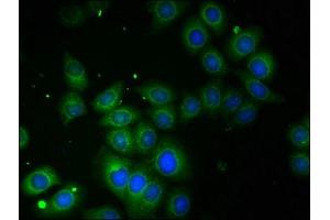 Immunofluorescent analysis of A549 cells using ABIN7142715 at dilution of 1:100 (TROVE2 抗体  (AA 3-535))
