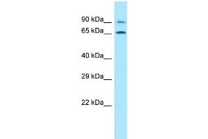 WB Suggested Anti-PALMD Antibody Titration: 1. (PALMD 抗体  (N-Term))