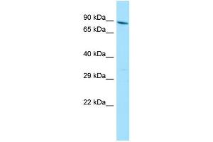 WB Suggested Anti-YTHDC1 Antibody Titration: 1. (YTHDC1 抗体  (N-Term))