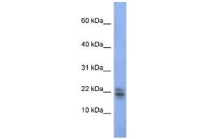 WB Suggested Anti-RNASE1 Antibody Titration:  0. (RNASE1 抗体  (Middle Region))