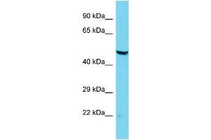 Host: Rabbit Target Name: DCAF12L2 Sample Type: Jurkat Whole Cell lysates Antibody Dilution: 1. (DCAF12L2 抗体  (N-Term))