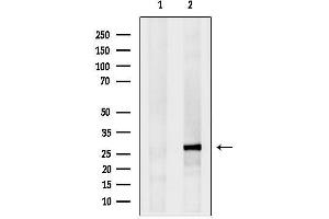 anti-Eukaryotic Translation Initiation Factor 4E Family Member 3 (EIF4E3) (Internal Region) antibody