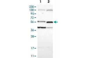 Western Blot analysis of Lane 1: RT-4 and Lane 2: U-251MG sp cell lysates with VIL1 polyclonal antibody . (Villin 1 抗体)