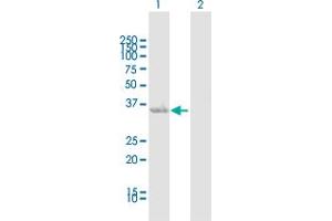 Western Blot analysis of AKR1C1 expression in transfected 293T cell line by AKR1C1 MaxPab polyclonal antibody. (AKR1C1 抗体  (AA 1-323))