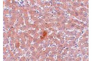 Immunohistochemical staining of rat liver tissue with 5 ug/mL KDM3A polyclonal antibody . (KDM3A 抗体  (N-Term))