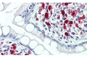 Immunohistochemistry (IHC) image for anti-Triggering Receptor Expressed On Myeloid Cells 2 (TREM2) (AA 1-228) antibody (ABIN7443632)