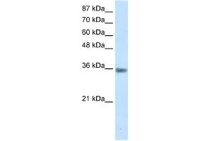 Western Blotting (WB) image for anti-Menage A Trois Homolog 1, Cyclin H Assembly Factor (Xenopus Laevis) (MNAT1) (C-Term) antibody (ABIN925893)