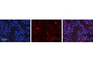 Rabbit Anti-TP53 Antibody   Formalin Fixed Paraffin Embedded Tissue: Human Lymph Node Tissue Observed Staining: Nucleus, Cytoplasm Primary Antibody Concentration: 1:100 Other Working Concentrations: 1:600 Secondary Antibody: Donkey anti-Rabbit-Cy3 Secondary Antibody Concentration: 1:200 Magnification: 20X Exposure Time: 0. (p53 抗体  (N-Term))