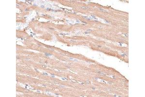 Immunohistochemistry of paraffin-embedded Rat heart using KIF14 Polyclonal Antibody at dilution of 1:100 (40x lens). (KIF14 抗体)