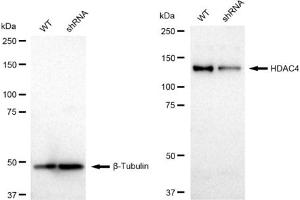 Western blotting analysis using HDAC4 antibody (ABIN7798933).